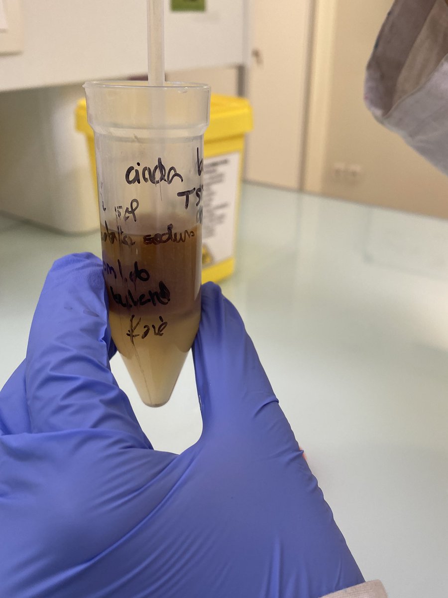 DelphineFoca's tweet photo. Extraction de la PAL hépatique et mise en évidence de son activité dans l’extrait obtenu #STL @LyceeHessel31 #Biotech @dest_BTK https://t.co/DGZTnbdYyt
