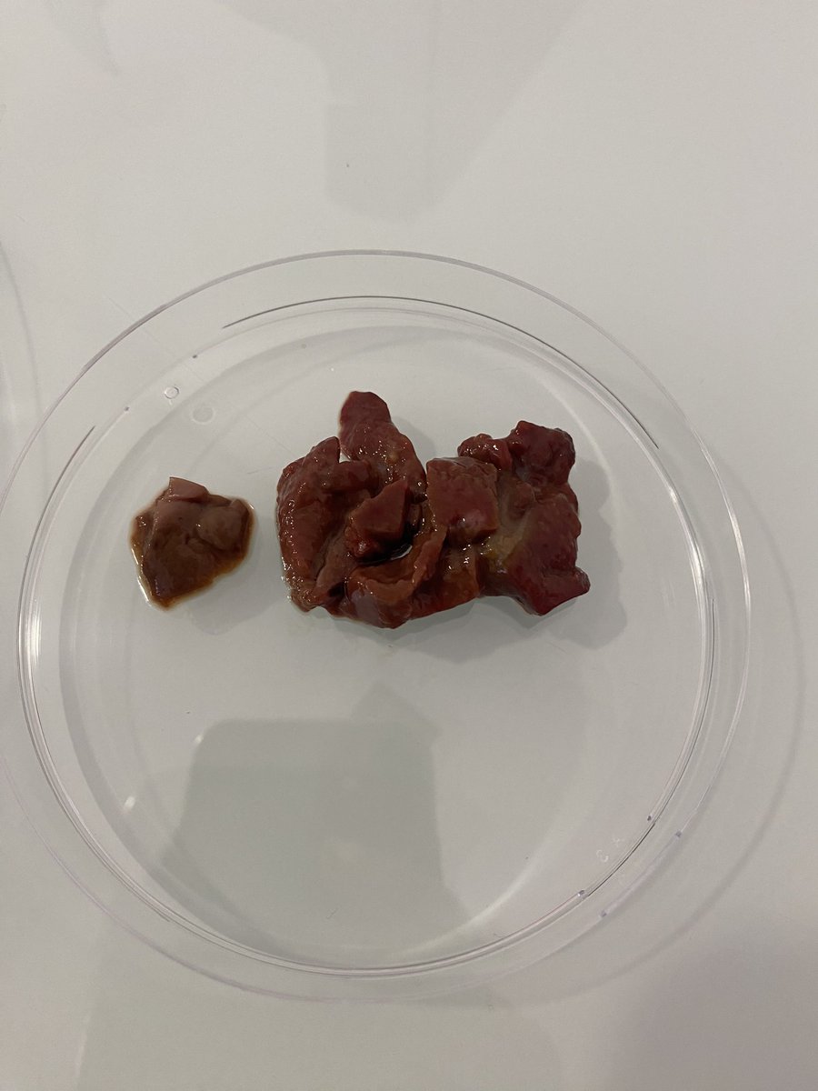 DelphineFoca's tweet photo. Extraction de la PAL hépatique et mise en évidence de son activité dans l’extrait obtenu #STL @LyceeHessel31 #Biotech @dest_BTK https://t.co/DGZTnbdYyt