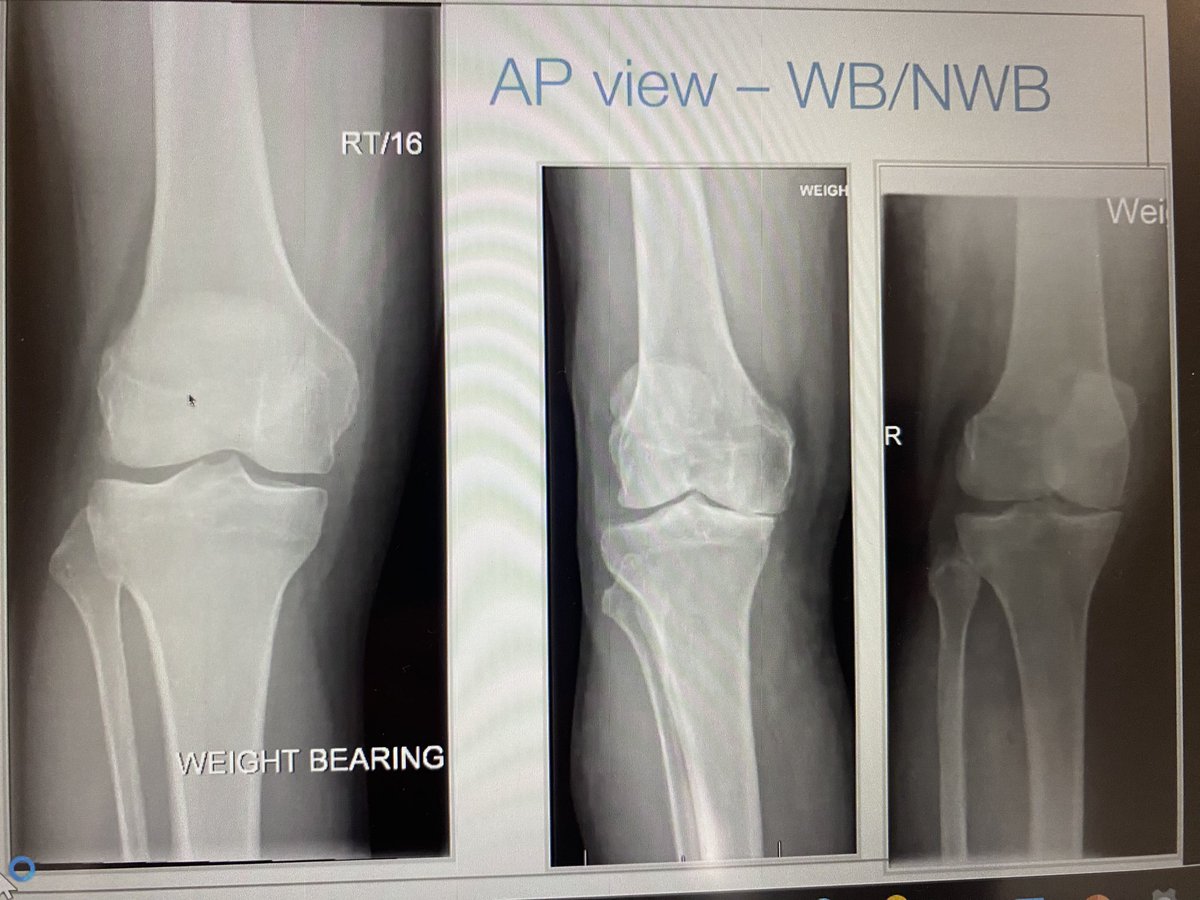 Great discussions this morning with <a href="/jessgent78/">Jessica Gent</a> around the holistic treatment of knee pain patients and where the imaging fits in. Giving clinicians lots of confidence to interpret images
#macpcourses <a href="/PhysioMACP/">MACP</a>