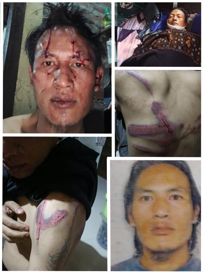 minkukizo's tweet photo. #ManipurViolence Victim Stories

Pu Tete was brutally beaten by a Meitei mob at his residence in New Lambulane. They struck him on the head, spat on him, and relentlessly kicked him until his legs and ribs were broken. They even forced him to utter the words, “I am a refugee.” Tragically, he succumbed to his injuries today.

This is just one of the countless stories of Kuki-Zo tribals who have been beaten, dehumanized, and abused. Many have faced the same fate—severely assaulted, their homes destroyed, and their dignity stripped away. From violent assaults to being driven from their homes, our people have suffered unspeakable acts of brutality, with little to no protection from the authorities. This ongoing violence continues to claim lives, while justice remains elusive for so many. @amnesty @hrw @volker_turk