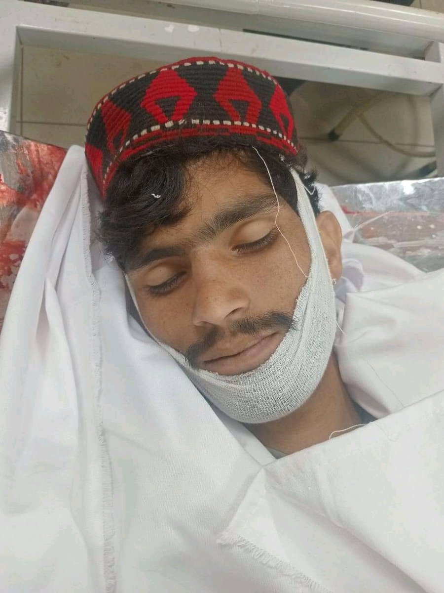 DostAafridi's tweet photo. پختون جرگہ پر پولیس کی فائرنگ سے ہمارے تین دوست اب تک شہید ہوچکے ہے
یہ لوگ اور اسکے دو فیصد سویلین شراکت دار یہ سمجھتے ہیں کہ مار پیٹ و ظلم و قتل عام سے پشتونوں کو چپ کروا دینگے۔ یہ آپکی بھول ہے۔ تم لوگوں نے ھمارے گھر گرائے جلائے،
#PQJ،
#PashtunNationalCourt11Oct https://t.co/IhVUmXcyWA