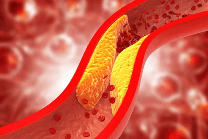 The most prolific serial killer in American history:

Heart disease.

It’s the cause of 1 in every 5 American deaths.

Wanna protect yourself?

Here are 10 foods that will unclog your arteries: