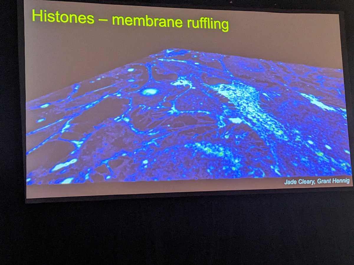Day 3 of <a href="/theTHORnetwork/">THOR_Network</a> starting off with <a href="/UVMTraumaLab/">Kalev Freeman</a> Kalev Freeman, MD giving a phenomenal talk about Calcium levels in severely injured and the effects on the endothelium.

#thor2024 #calcium #histones #coag #MedX