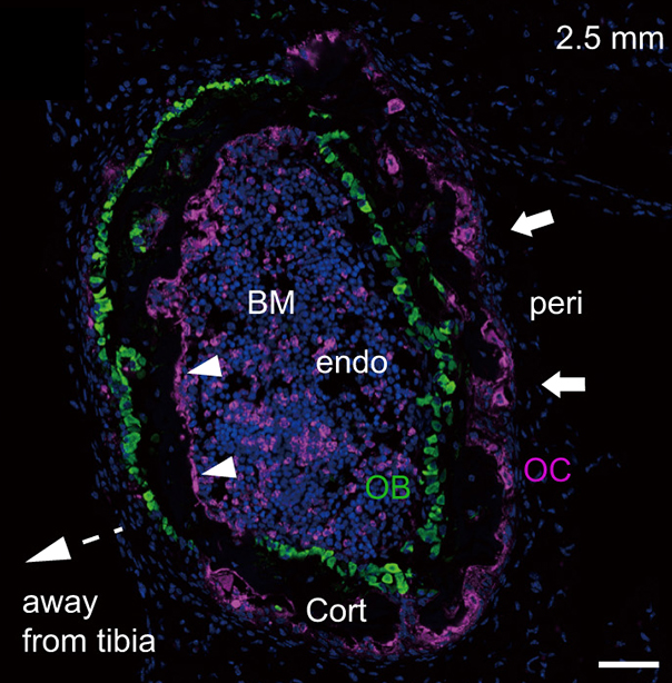 PNASNews's tweet photo. By better understanding the microscopic details of how surrounding #tissue impacts #BoneDevelopment, researchers hope to find ways to remodel bone and treat #fractures or other bone ailments. In PNAS Journal Club https://t.co/PvCbz0alIZ #osteoclast #osteoblast #microscopy https://t.co/W2Hu2ySJBx