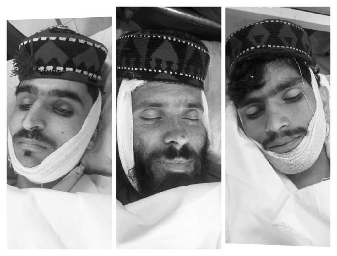 Muhammadjan0305's tweet photo. We will never forget the barbaric attack on PTM activists at Pashtun jarga.
This is not just attack but disturb the peace of Pakhtuns,and state will regret it. 
We stand with our beloved peoples against the cruel action of state. https://t.co/wY8WoRJ0fN