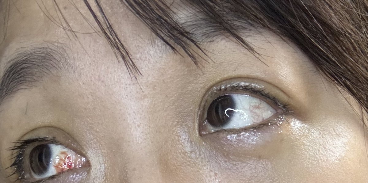 0淚水
讓我根本沒辦法好好生活