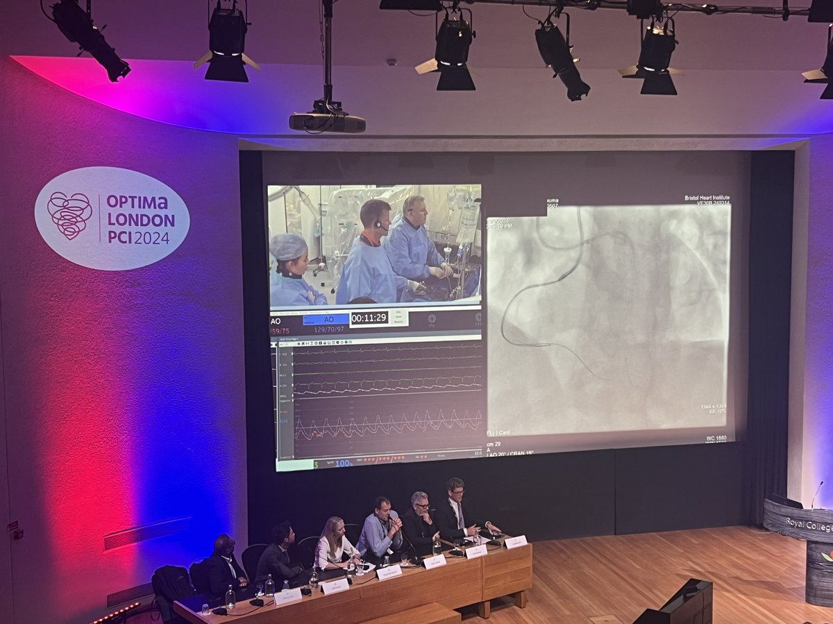 Seigla Medical  #LiquID guide extension in action at Optima Education Ltd . in London.

Simon Walsh and Julian Strange efficiently performing reverse CART in an RCA CTO.

Great case, great course.

#complexpci #ctopci
