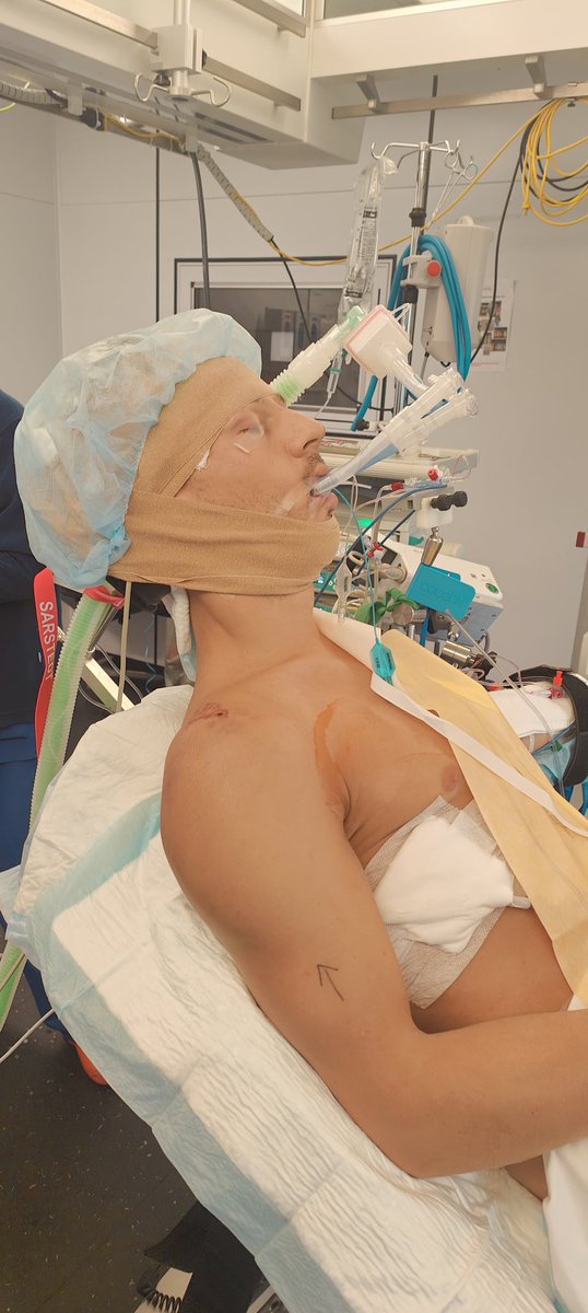 DomiAegerter77's tweet image. Danke Dr. Stefan Joss und dem Ärzten Team von Hirslanden Klinik Beau-Site Bern für die super Betreuung und die neuen Tunning teile ⛓️🔩💪🥴😅 

#post #surgery #shoulder #right #recovery #built #strength #scan #beach #doctor #treatment #77 #livefullgas #domifighter 

@hirslanden