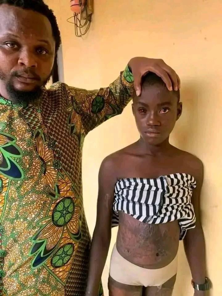 akpenmaxwell850's tweet photo. Please let’s repost till the authorities sees it the 
Human beings are so inhuman .. let the whole world sees this ..
 The wickedness of man has no limit 

#burnaboy #davido #wizkid #moreayo #tinubu #verydarkman https://t.co/v8jhCIThf0