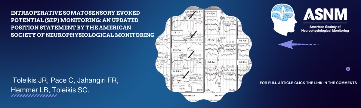 TheASNM's tweet photo. Somatosensory evoked potentials (SEPs) play a crucial role in evaluating the functionality of somatosensory pathways during surgical procedures. Their use is essential for preserving patients' neurological integrity. https://t.co/wbXSUcU1Cg