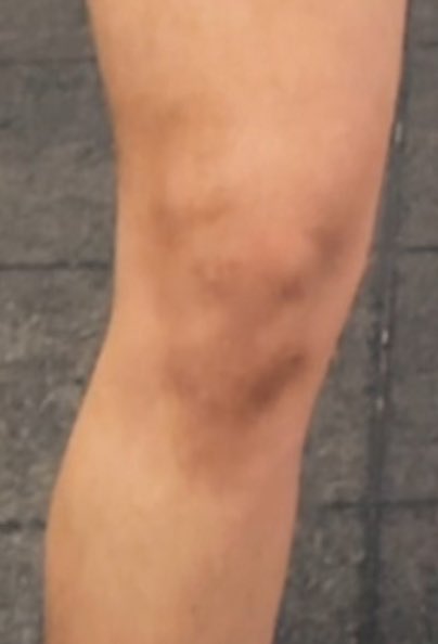 dislexico93's tweet photo. Me saqué una selfie en el gym y resulta que mis rodillas son un koala y un demonio https://t.co/JtOV5L4sK9