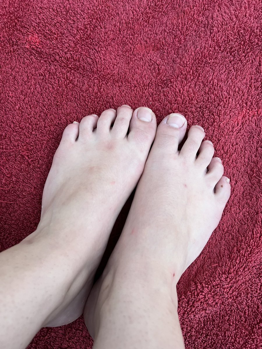 TwoPrettyFeet's tweet image. Before vs after. Which do you prefer? Add me on sc for the during pictures 🤭