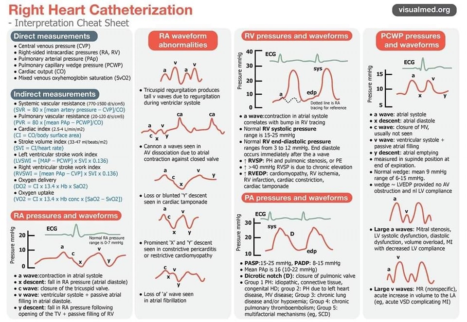 🔴 Right Heart Catheterization Cheat Sheet: Interpretation of Pressures and Waveforms 

#RHC #Interpretation #Diagnosis #RightHeartCatheterization #CheatSheet #Waveforms #Cardiology #CardioTwitter #cardiology #CardioEd #cardiotwiteros #mustread #medtwitter #meded #medtwitterwhat