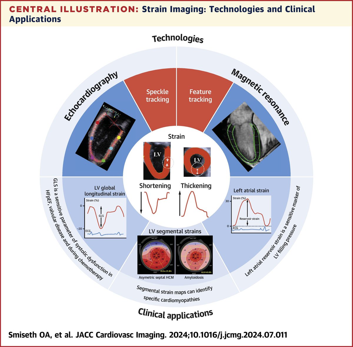 ZHeart11768530's tweet photo. 🔴Myocardial Strain Imaging: Theory, Current Practice, and the Future⤵️State-of-the-Art #2024Review #openaccess #JACCIMG

🔹https://t.co/adVEEGR8C4
#echofirst #CardioX #Cardiology #FOAMed #MedEd #medstudent #paramedic #Cardiology #CardioEd #ECG  #medtwitter #meded #CardioTwitter https://t.co/wdxP8XVfOi