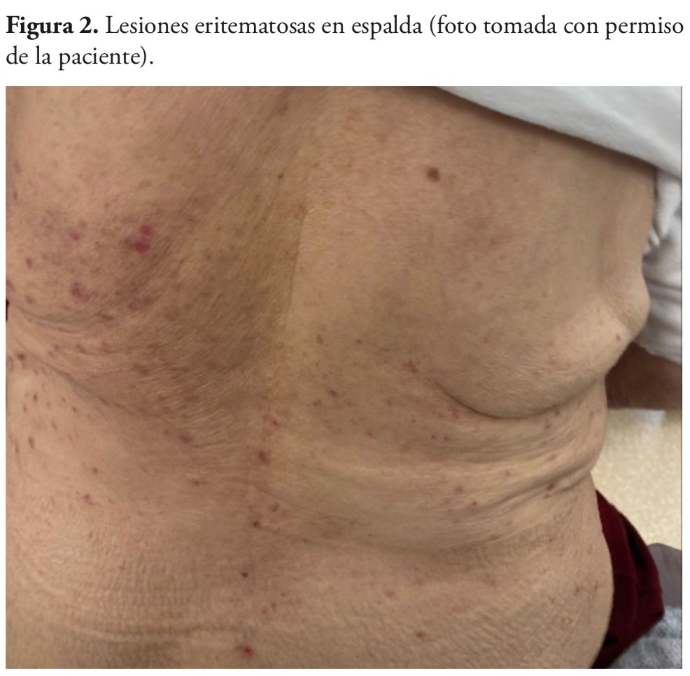 🔰#Diabetes Práctica destaca caso clínico 🗂️

⚠️Desenredando el enigma: prurito en una paciente con diabetes de edad avanzada

El estrecho seguimiento del caso por enfermería y medicina desde Atención Primaria, dejan una clara conclusión y reflexión.  👇🏼

diabetespractica.com/files/123/art4…