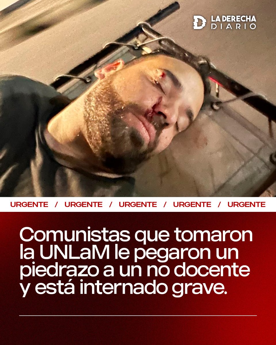 🇦🇷 | #URGENTE Comunistas asesinos: Militantes de izquierda que tomaron la Universidad de La Matanza le pegaron un piedrazo a un no-docente de nombre Gustavo Iaconis, y está internado en el Hospital Italiano en estado grave.