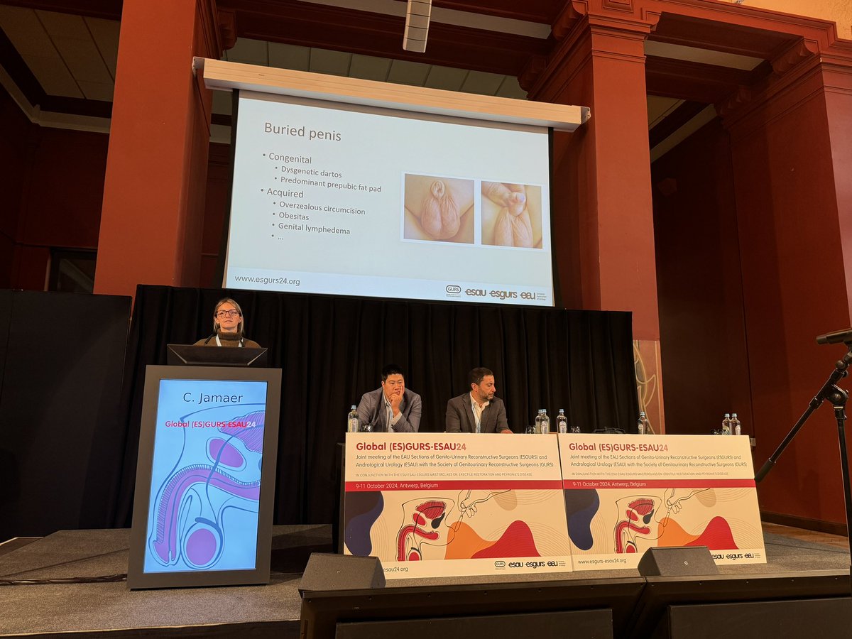Dr Ward Sam (@dr_wardsam) on Twitter photo MD, friend and colleague <a href="/caroline_jamaer/">Caroline Jamaer</a> rocking the floor at ESGURS/ESAU24 - talking about burried penis - what to do to help those young guys? <a href="/AFSpinoit/">AFrançoise Spinoit</a> <a href="/Uroweb/">European Association of Urology (EAU)</a> <a href="/JessaZiekenhuis/">Jessa Ziekenhuis</a> <a href="/KoenraadvanRen1/">Koenraad van Renterghem</a> <a href="/donwglee/">Wai Gin (Don) Lee</a> MD, friend and colleague <a href="/caroline_jamaer/">Caroline Jamaer</a> rocking the floor at ESGURS/ESAU24 - talking about burried penis - what to do to help those young guys? <a href="/AFSpinoit/">AFrançoise Spinoit</a> <a href="/Uroweb/">European Association of Urology (EAU)</a> <a href="/JessaZiekenhuis/">Jessa Ziekenhuis</a> <a href="/KoenraadvanRen1/">Koenraad van Renterghem</a> <a href="/donwglee/">Wai Gin (Don) Lee</a>
