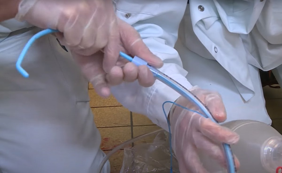 ____Dopamine___'s tweet photo. Connaissez vous bien toutes les aides à l'intubation oro-trachéale ?

Testez vous avec ce Quiz !

cc @SFMU_MS @SFARJeunes @SNIA75 @IADE_de_France 

https://t.co/9FRZnJCU8N https://t.co/g4TH5H3ACu