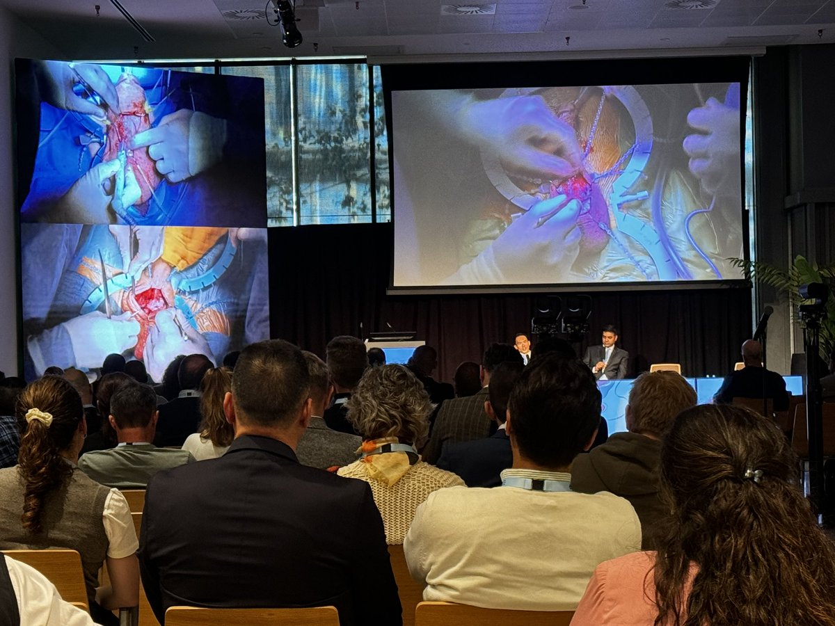 📡 Live from #ESGURS24

<a href="/drMarcoFalcone1/">Marco Falcone</a> performing Rigicon’s #PULSE novel inflatable penile implant surgery.

Interesting blend of best practices from both sides of the pond are brought forward by moderators <a href="/JSimhan/">Jay Simhan, MD</a> &amp; <a href="/donwglee/">Wai Gin (Don) Lee</a> 

<a href="/rigiconurology/">Rigicon® Prosthetic Urology</a> <a href="/yoursexmedjour/">IJIR: Your Sexual Medicine Journal</a> <a href="/Uroweb/">European Association of Urology (EAU)</a>