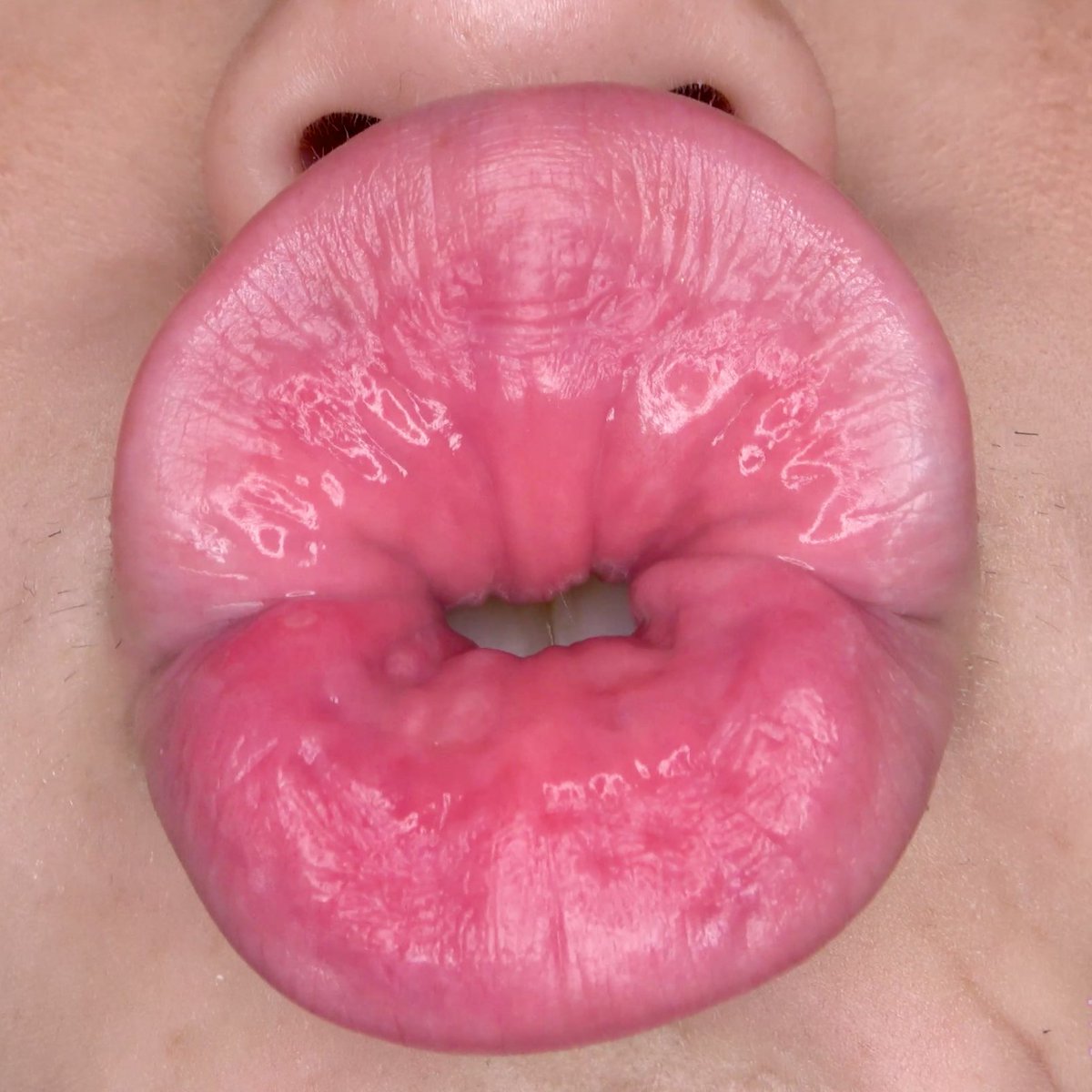 タコチュー エロ 