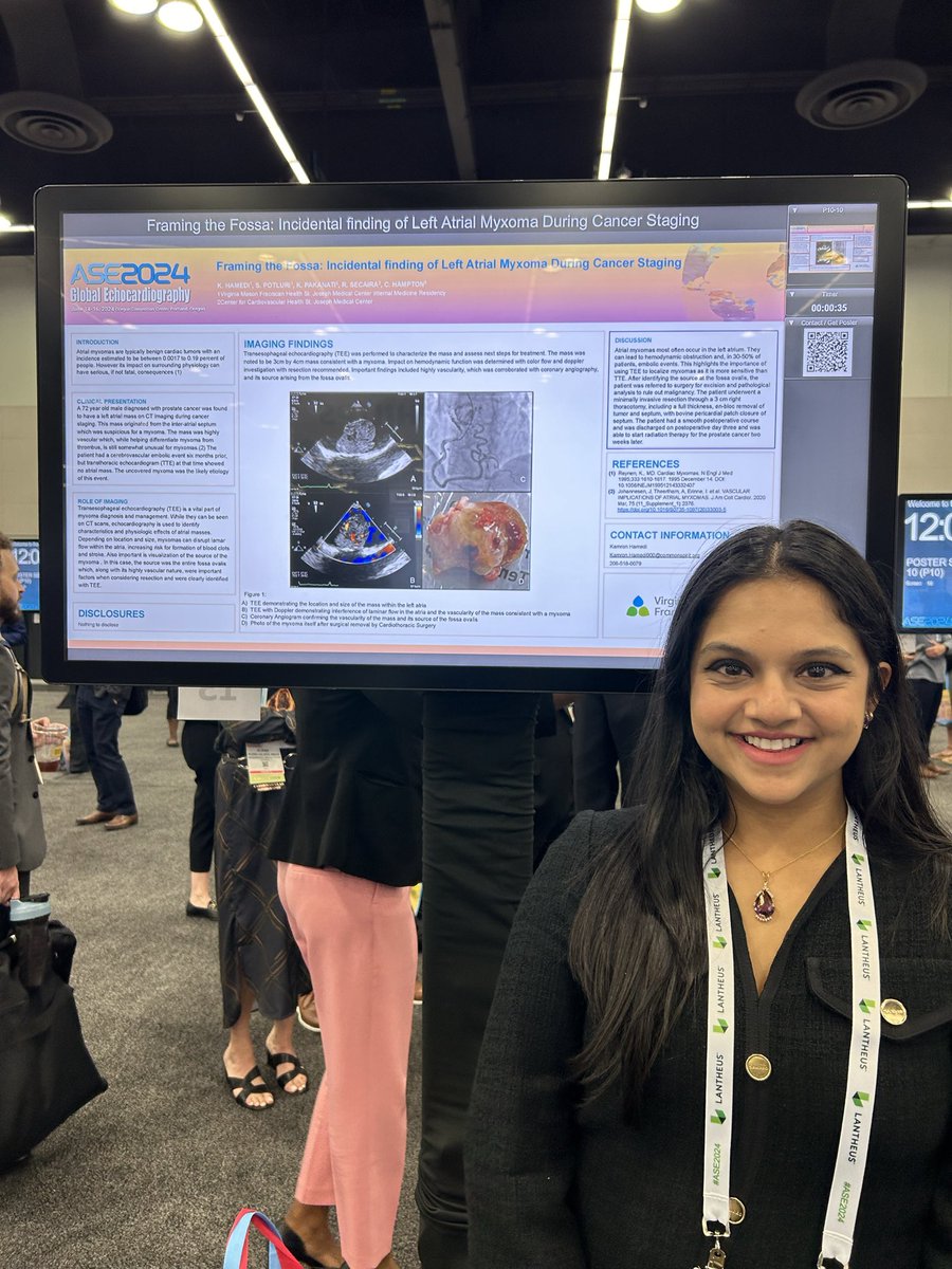 VMFHCards's tweet photo. Last Spring, Keerthana (pgy4) presented an interesting case at @ASE360 with our amazing IM resident colleagues about an incidentally found L atrial myxoma! #echofirst #imaging #accfit https://t.co/qVXWNJpxJW
