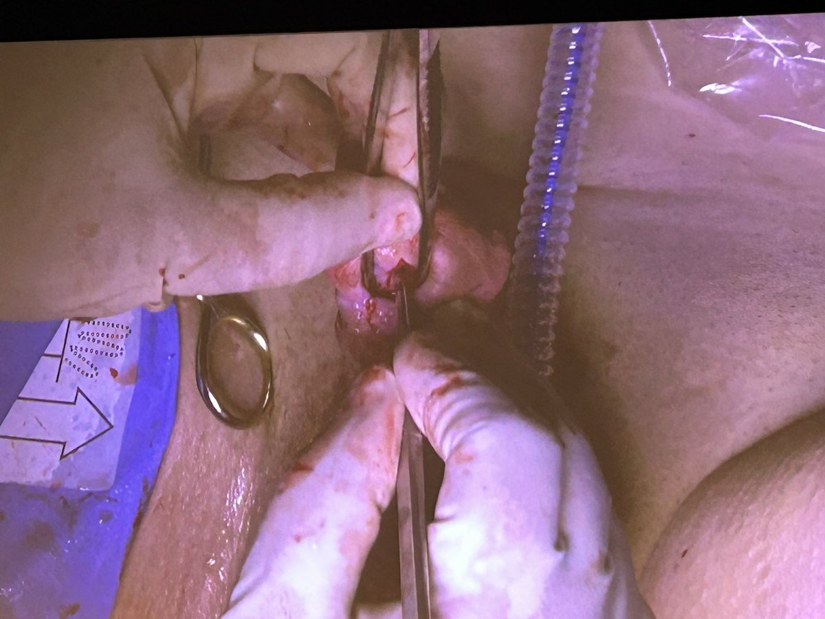 Rowland Rees tweet media