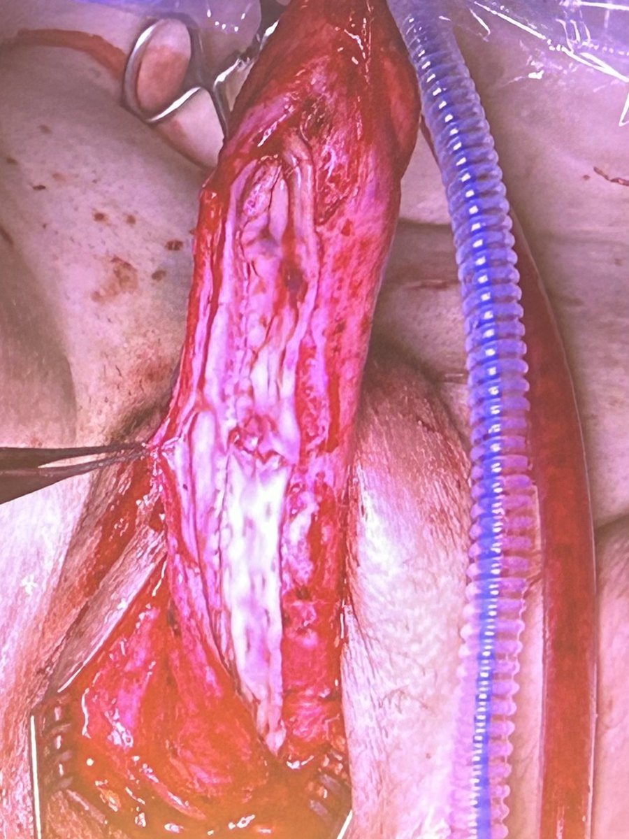 Rowland Rees tweet media