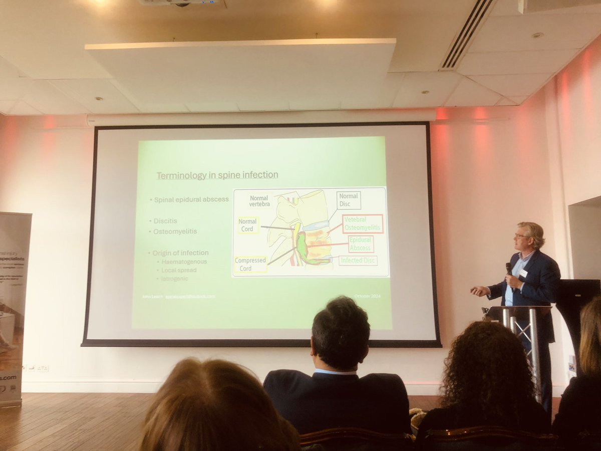 Hawre Ali (@hallli98) on Twitter photo Amazing talk by Mr John Leach at the Deka Conference on surgery in clinical negligence claims! <a href="/DekaChambers/">Deka Chambers</a> <a href="/BBK_Spinal/">BBK Spinal Team</a>
Key takeaway: missed opportunities to diagnose spinal infections can occur even when there are no neuro deficits.
#ClinicalNegligence #spinalhealth Amazing talk by Mr John Leach at the Deka Conference on surgery in clinical negligence claims! <a href="/DekaChambers/">Deka Chambers</a> <a href="/BBK_Spinal/">BBK Spinal Team</a>
Key takeaway: missed opportunities to diagnose spinal infections can occur even when there are no neuro deficits.
#ClinicalNegligence #spinalhealth