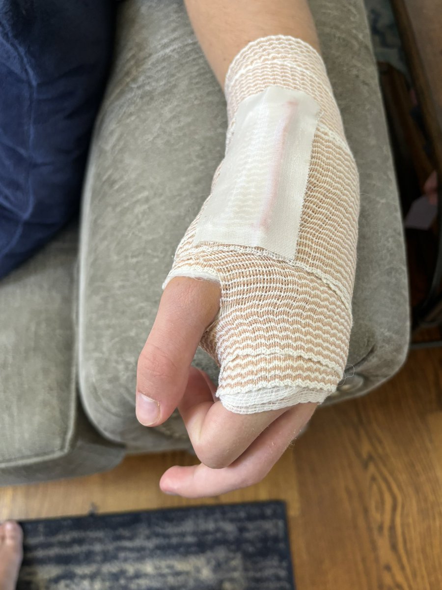 Mitchell Coons (@mitchellcoons) on Twitter photo Road to recovery! Hard to believe I played most of the summer with a broken bone in my wrist! Can’t wait to get back to the weight room and the baseball field!
<a href="/615Cba/">CBA-Southeast</a> <a href="/coachtresch/">Shane Tresch</a> <a href="/volcard/">Jason Patterson</a> <a href="/CMS_BSB/">CMSBaseball</a> Road to recovery! Hard to believe I played most of the summer with a broken bone in my wrist! Can’t wait to get back to the weight room and the baseball field!
<a href="/615Cba/">CBA-Southeast</a> <a href="/coachtresch/">Shane Tresch</a> <a href="/volcard/">Jason Patterson</a> <a href="/CMS_BSB/">CMSBaseball</a>