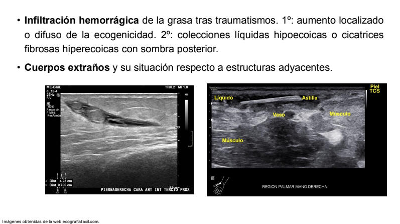 FormacionCalzad's tweet photo. ¡¡Adiós, ecografía abdominal. Hola, ecografía osteomuscular!! Empezamos por las generalidades. 👋🏃🏃‍♂️💨💪 #juevesecográficos
https://t.co/vdiQ4SXvgg https://t.co/OOvTTSzrE3