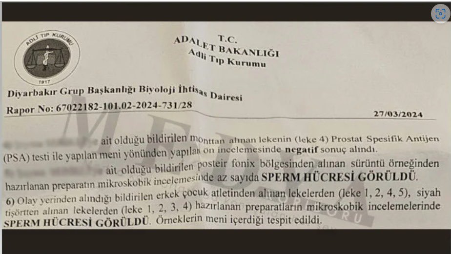 ⚠️Batman da 8 yaşında konuşma yetisini yitiren
⚠️İpe bağlı halde bulunan
⚠️Adli Tıp Raporunda sperm bulunan
🆘Davası kapatılan kızı merak eden/yazan/soran/araştırmak/öğrenmek isteyen bi ben miyim?
#Batman