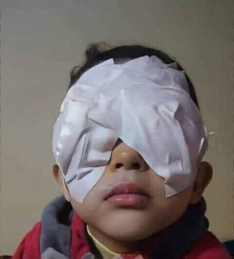 ده محمد ابن صاحبي أتولد كفيف وربنا قدرهم وباعو كل اللى حيلتهم وعملولو عملية زرع قرنية والمفروض أنه هيشيل الشاش بكره.
بستحلفكم بالله وحياة ولادكم وحياة كل حاجة بتحبوها تدعولو ان العملية تكون نجحت ويشوف الدنيا اللى اتحرم منها من يوم ماتولد دعوة 40 غريب مستجابة أعتبره ابنك او اخوك😔