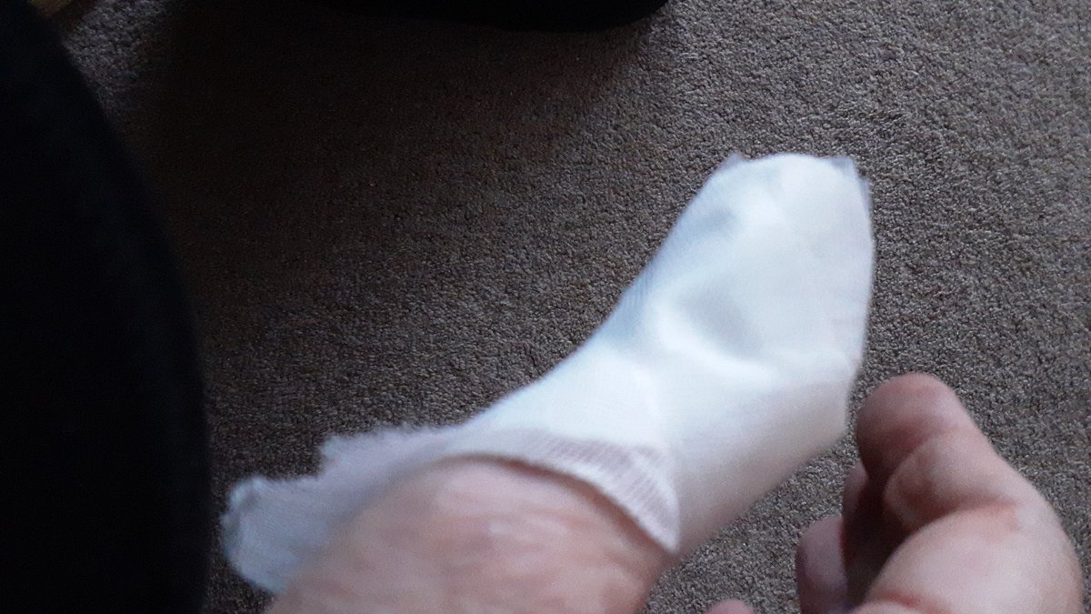 jaydee_97's tweet photo. Slicing my thumb with the corned beef tin wasn't actually on my todo list today 🙄 #ReallyDeep #BloodySore https://t.co/XcfS2rVcsT