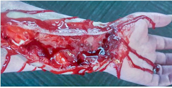 moulageconcepts.com/single-post/ch… 

More than just theatre, understanding outcomes, assessing your objectives, considering your audience, and selecting quality products will lead to more effective and engaging simulation modeling experiences.
moulageconcepts.com #sim #training #moulage