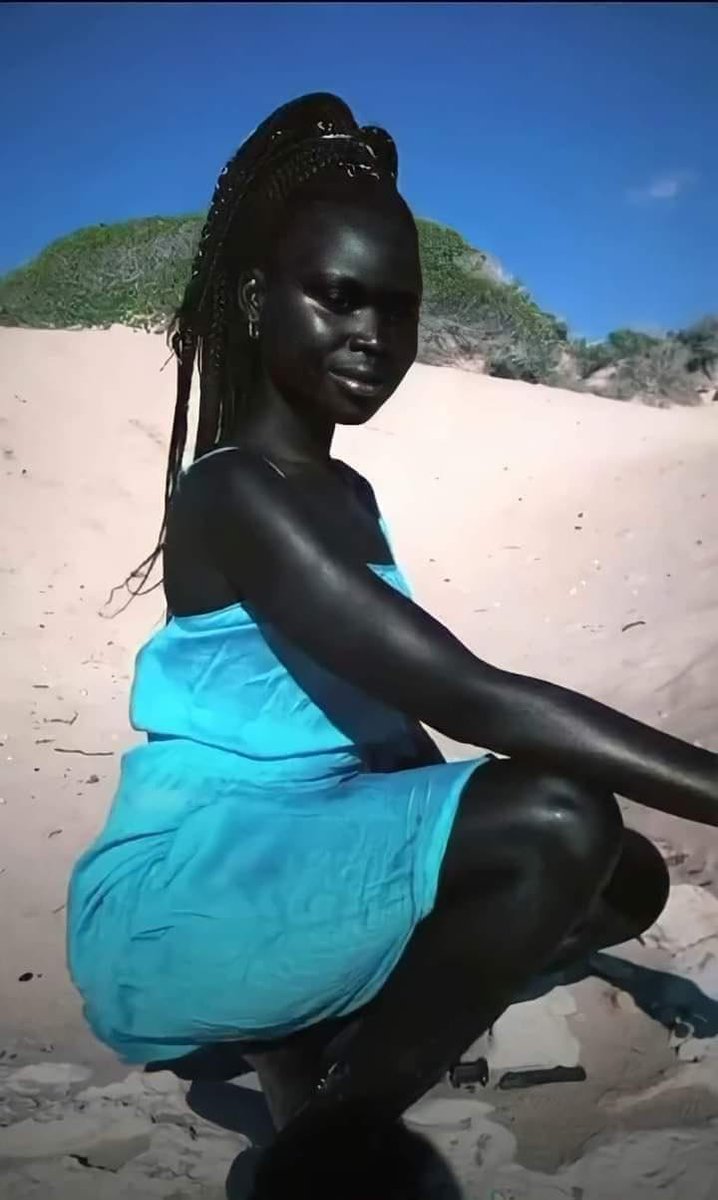 Bio_comunidad's tweet photo. Ella es Nyakim Gatwech, una modelo sudanesa de 31 años, conocida como “la reina de la oscuridad” por su distintivo y fascinante tono de piel

La piel humana obtiene su color de los melanocitos, células especializadas ubicadas en la epidermis que producen un pigmento llamado melanina.

La melanina es responsable de la variación del color de la piel: a mayor producción de melanina, la piel tiende a ser más oscura (hiperpigmentación), mientras que una menor cantidad resulta en piel más clara (hipopigmentación).

La despigmentación se refiere a la ausencia casi total de melanina, lo que puede dar lugar a condiciones como el albinismo.

Además, no solo la cantidad de melanina influye en el tono de la piel, sino también el tamaño y la actividad de los melanocitos. Los melanocitos más grandes y activos tienden a producir piel más oscura.

El papel de la melanina va más allá del color; también ofrece cierta protección contra la radiación ultravioleta (UV), ayudando a prevenir daños celulares y reduciendo el riesgo de cáncer de piel.