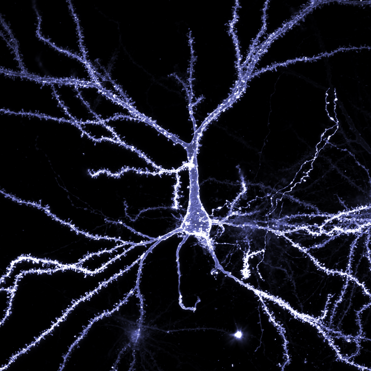 stephjhuang's tweet photo. I guess that's why they're called pyramidal neurons! #FluorescenceFriday https://t.co/Vcdufh8ykm
