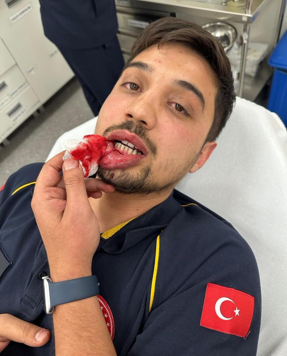 📍 Bursa 112
Paramedik arkadaşımız vaka başında darp edilmiş.
Geçmiş olsun diliyoruz.
Sağlık Bakanı dün sağlıkta şiddet için mevzuatın yeterli olduğunu ve şiddetin azaldığını açıklamıştı.

Sağlıkta şiddeti bitirin!
#beyazkod1111
<a href="/dayanismasen/">Birlik ve Dayanışma Sendikası</a> 
<a href="/dayanismasen3/">BDS 3 NOLU ŞUBE</a>