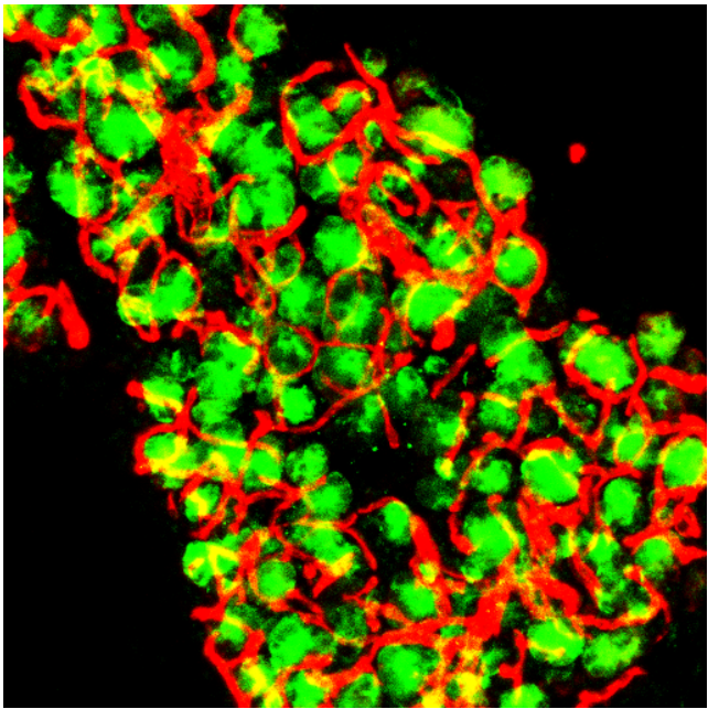 Qi39910's tweet photo. Neurovascular coupling has been investigated for decades but no other cells are reported to have similar nice alignment with blood vessel. Our recent work reports the importance of ductal-endothelial alignment during pancreatic inflammation. 

https://t.co/ONg7g97dpM https://t.co/vkrrRDIIKS