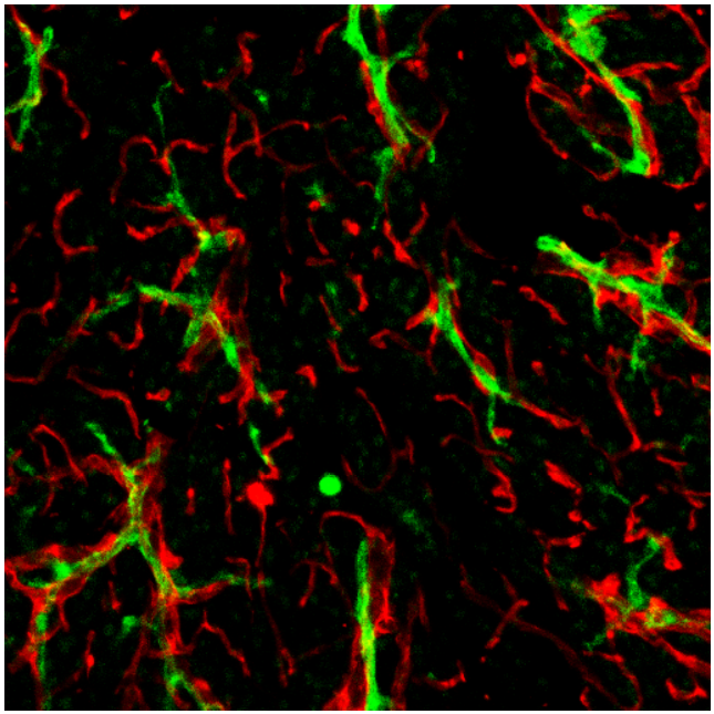 Qi39910's tweet photo. Neurovascular coupling has been investigated for decades but no other cells are reported to have similar nice alignment with blood vessel. Our recent work reports the importance of ductal-endothelial alignment during pancreatic inflammation. 

https://t.co/ONg7g97dpM https://t.co/vkrrRDIIKS