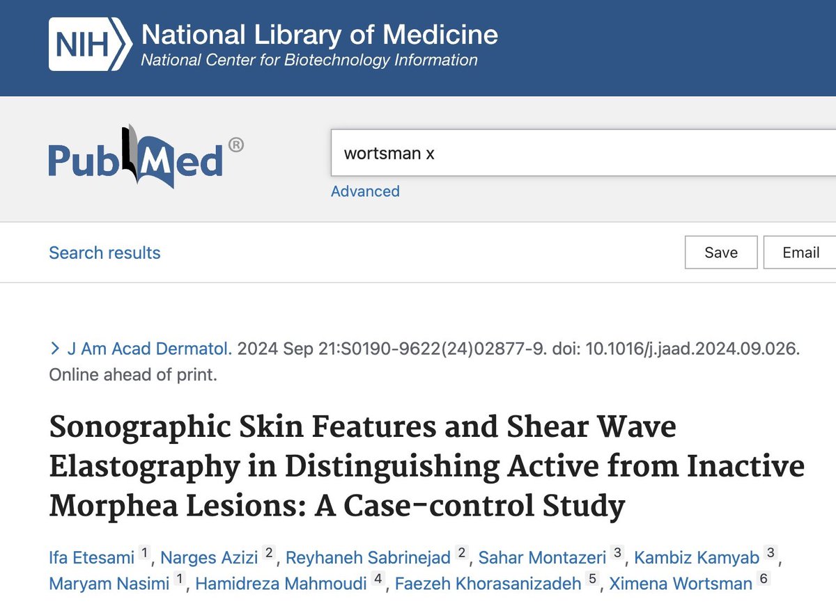 🔥🔥🔥This case-control study evaluates the effectiveness of ultrasound (greyscale, color Doppler, and shear wave elastography (SWE) in distinguishing between active and inactive morphea lesions, aiming to improve the accuracy of morphea management. Our results indicated that the