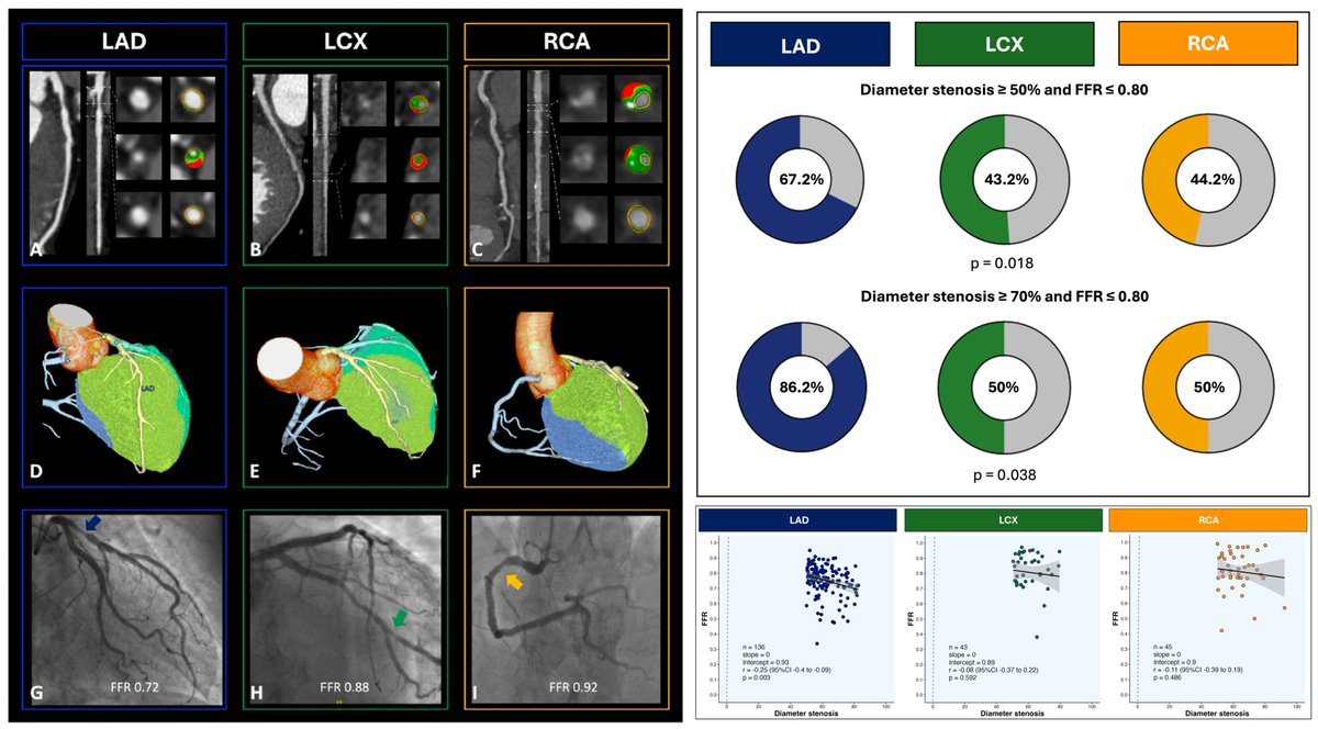 🔥Discrepancies between CCTA-diameter stenosis and ischemia (FFR≤0.80) might depend on vessel type.

🎯Could integrating morphological plaque features stratified by vessel improve accuracy in identifying vessel-specific ischemia?

Read more in JCCT👇
journalofcardiovascularct.com/article/S1934-…