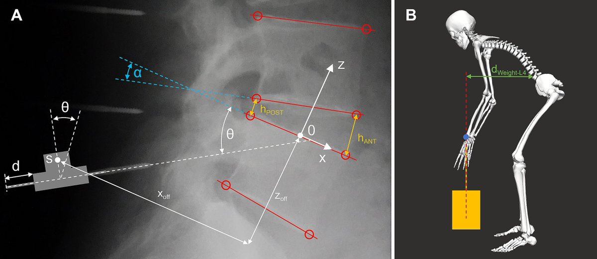😃New article published in J Biomech!

"Intervertebral disc deformation in the lower lumbar spine during object lifting measured in vivo using indwelling bone pins", by Schmid et al.

#journalofbiomechanics

👀sciencedirect.com/science/articl…