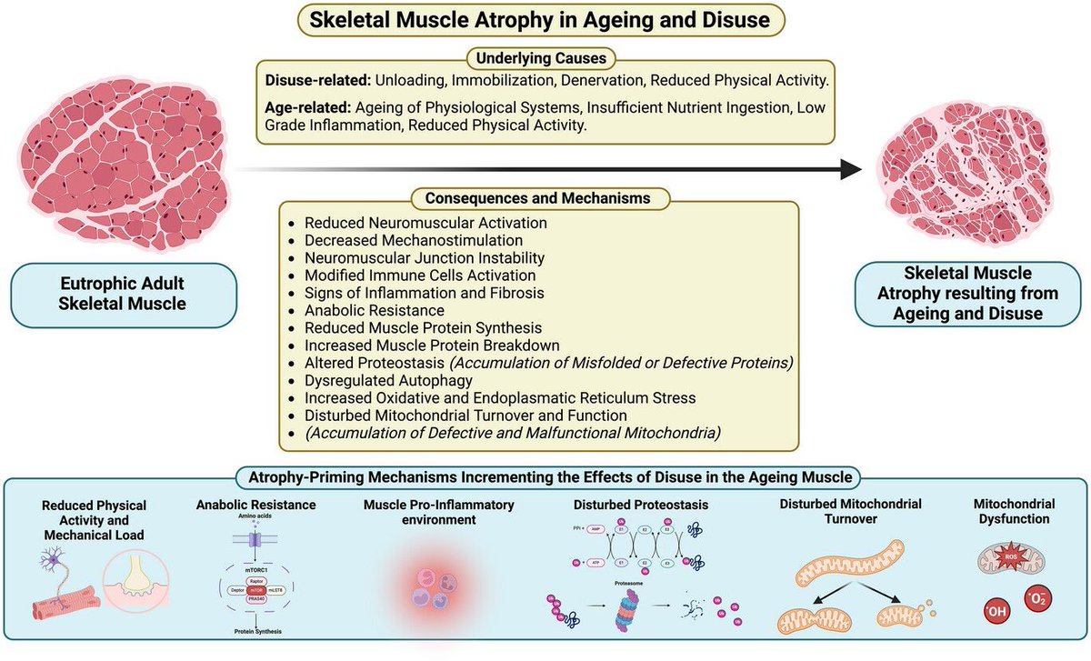 Experimental Physiology (@expphysiol) on Twitter photo <a href="/james_mckendry/">James McKendry, Ph.D.</a>, <a href="/GiuliaLColetta/">Giulia Coletta</a>, <a href="/nunesea/">Everson Nunes</a>, <a href="/ChanghyunLim1/">Changhyun Lim</a> and <a href="/mackinprof/">Stuart Phillips (he/him)</a> (<a href="/MacKinesiology/">McMaster Kinesiology</a>) demonstrate how #resistanceexercise can be a critical countermeasure in mitigating disuse-induced skeletal muscle atrophy in #ageing!
šbuff.ly/3NsWYSV <a href="/james_mckendry/">James McKendry, Ph.D.</a>, <a href="/GiuliaLColetta/">Giulia Coletta</a>, <a href="/nunesea/">Everson Nunes</a>, <a href="/ChanghyunLim1/">Changhyun Lim</a> and <a href="/mackinprof/">Stuart Phillips (he/him)</a> (<a href="/MacKinesiology/">McMaster Kinesiology</a>) demonstrate how #resistanceexercise can be a critical countermeasure in mitigating disuse-induced skeletal muscle atrophy in #ageing!
šbuff.ly/3NsWYSV