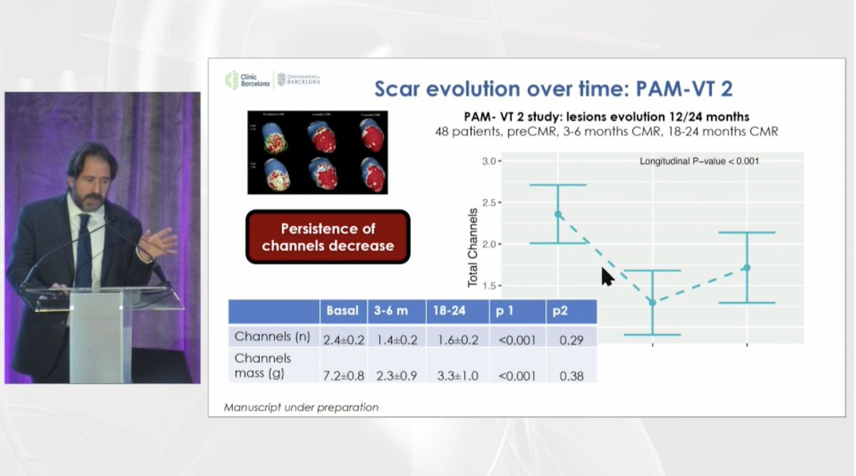Dr. Roca-Luque <a href="/ivroca/">Ivo Roca, FEHRA, FESC</a> discusses the role of CMR in evaluating ablation success and RF lesion evolution at the 2024 VT Symposium. #CardioTwitter #Cardiology #EPeeps #MedTwitter

Register to watch the VT Symposium livestream now: vtsymposium.com/registration