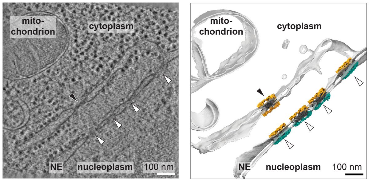 Beck Laboratory (@beck_laboratory) on Twitter photo Did you know that nuclear pore complexes can turn up outside the nuclear envelope? Studying these, <a href="/JennySachweh/">Jenny Sachweh</a>, Bernhard Hampoelz and others uncover that the surrounding cellular milieu determines NPC composition via the nuclear transport system itself. #teamtomo #NPC A 🧵 Did you know that nuclear pore complexes can turn up outside the nuclear envelope? Studying these, <a href="/JennySachweh/">Jenny Sachweh</a>, Bernhard Hampoelz and others uncover that the surrounding cellular milieu determines NPC composition via the nuclear transport system itself. #teamtomo #NPC A 🧵