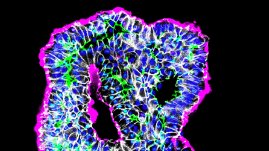 GurdonInstitute's tweet image. Still time to apply for a 4-year PhD studentship jointly supervised by @LabRawlins @Cambridge_Uni and @LuigiAloia82 @ASTRAZENECAUK. A fantastic opportunity to work with organoids, AI and cancer biology: jobs.cam.ac.uk/job/48526/