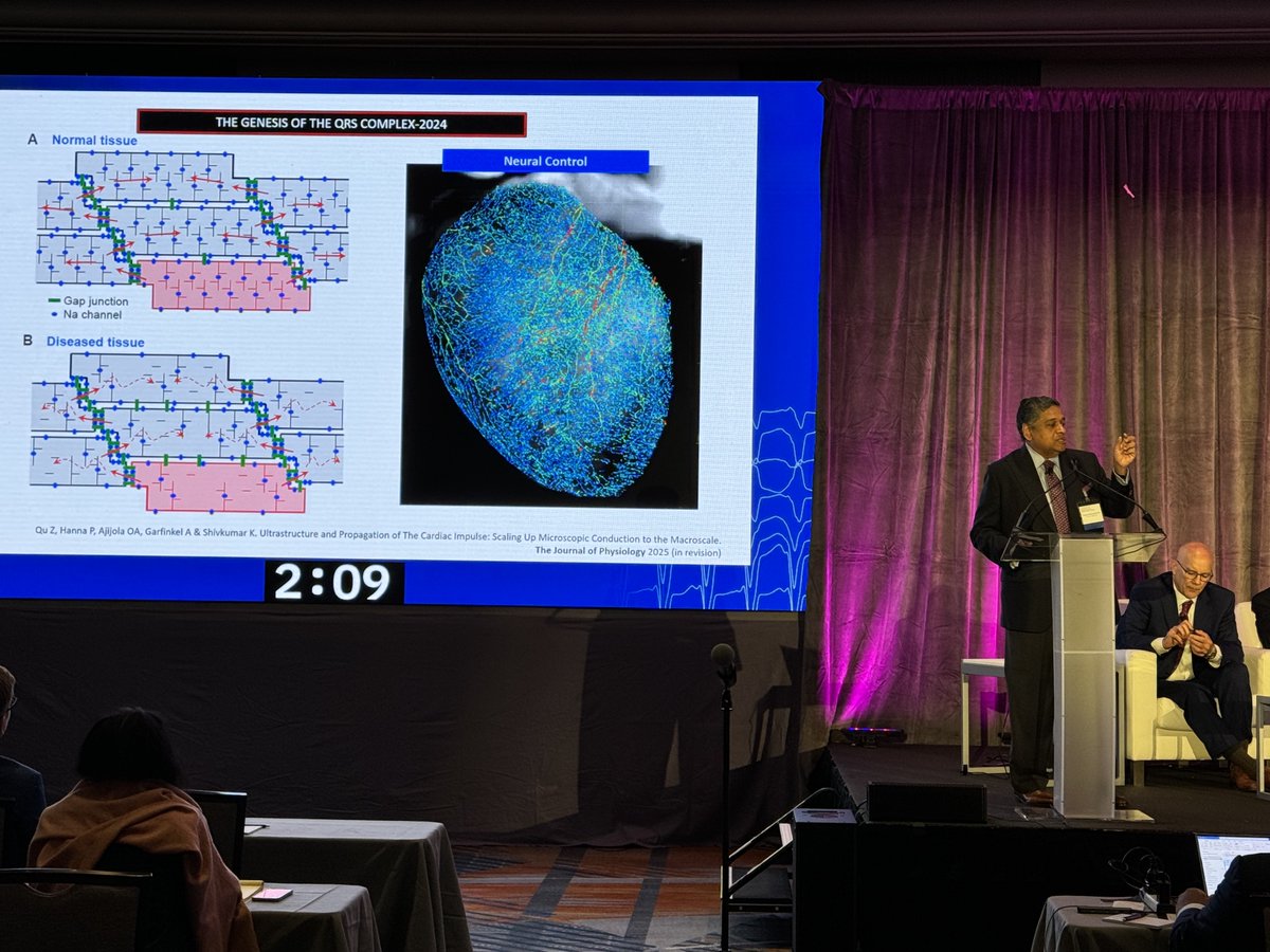 VT Symposium (@vtsymposium) on Twitter photo Dr. Shivkumar <a href="/shivkumarmd/">Kalyanam Shivkumar MD PhD</a> discusses the basic mechanisms of ventricular arrhythmias at the 2024 VT Symposium. #CardioTwitter #medtwitter #Epeeps #Cardiology
Register to watch the VT Symposium livestream now: vtsymposium.com/registration Dr. Shivkumar <a href="/shivkumarmd/">Kalyanam Shivkumar MD PhD</a> discusses the basic mechanisms of ventricular arrhythmias at the 2024 VT Symposium. #CardioTwitter #medtwitter #Epeeps #Cardiology
Register to watch the VT Symposium livestream now: vtsymposium.com/registration