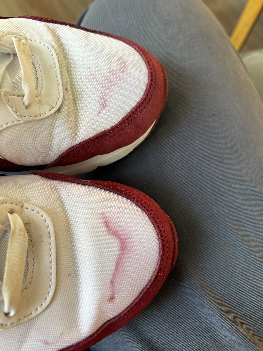 ScienceDaniel's tweet photo. @nike_co_uk my wife’s trainers look like this after being caught in the rain once. Is this something that should happen on an item of clothing designed for outdoor use?? https://t.co/ALwIs1HdP0