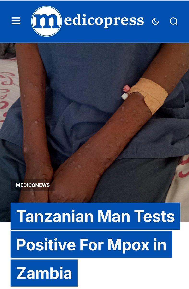 While the patient showed no signs or symptoms of Mpox at the time of crossing, he later sought medical attention at a Zambian clinic on October 2, 2024. 

⤵️Link: medicopress.media/tanzanian-man-…
