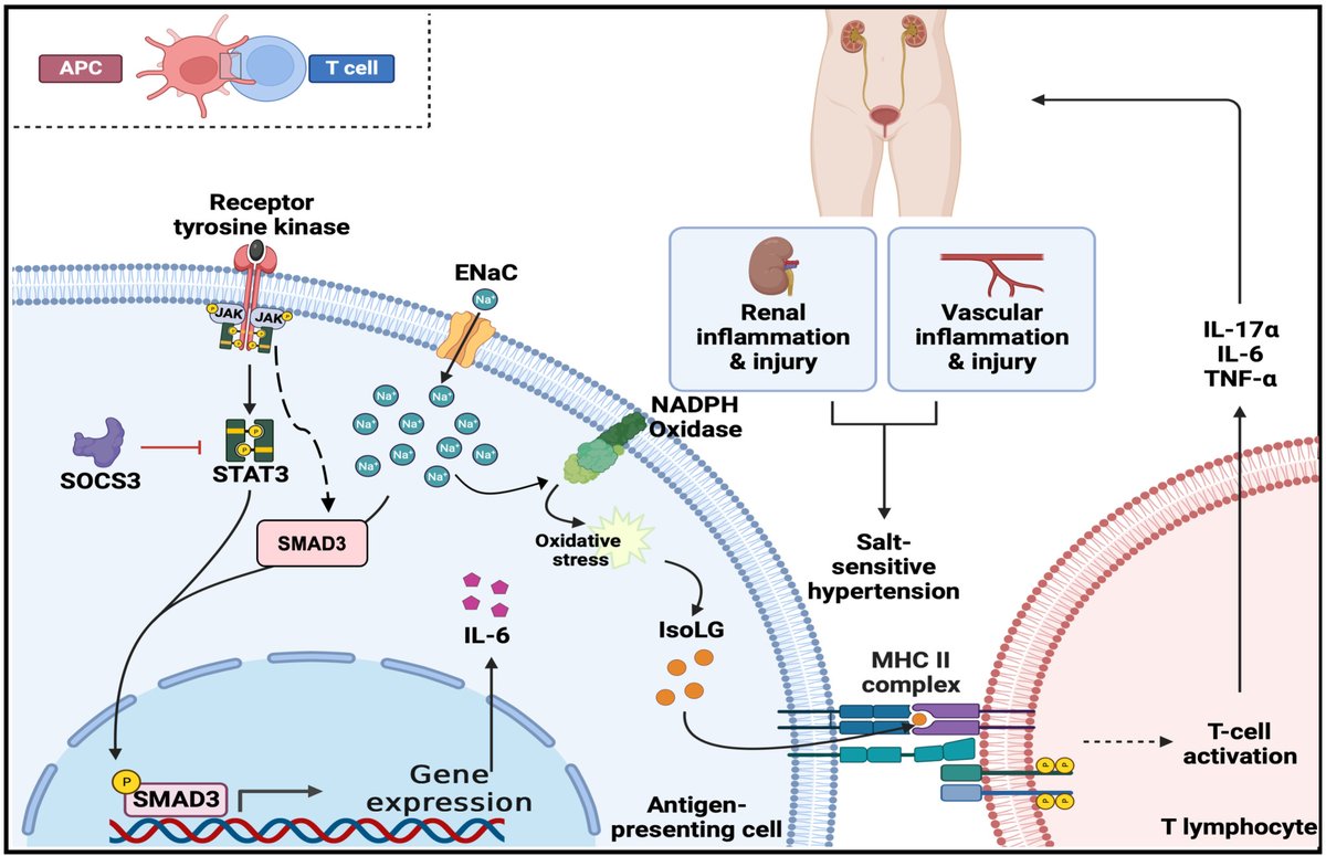 Circulation Research (@circres) on Twitter photo <a href="/saleemMMH/">Mohd Saleem</a> reveal the #APC #JAK2 signaling as a potential target for diagnosing & treating #SSBP in humans ahajrnls.org/3ZYlvXx
<a href="/annetkiraboc1/">Annet Kirabo D.V.M., M.Sc., Ph.D., F.A.H.A.</a> <a href="/ashleypitzer/">ashley pitzer</a> <a href="/LErtuglu/">Lale Ertuglu, MD</a> <a href="/isjaima/">Jeanne A. Ishimwe, PhD</a> <a href="/CWanjallaMDPhD/">Celestine Wanjalla</a> <a href="/NstorPastor/">Néstor de la Visitación</a> <a href="/PaulKastner128/">Paul Kastner</a> <a href="/DoctorAlbritton/">Claude F. Albritton II</a> <a href="/drtasir2011/">Taseer Ahmad Pharm.D, MPhil, PhD</a> <a href="/AlexBickMDPhD/">Alex Bick</a> <a href="/saleemMMH/">Mohd Saleem</a> reveal the #APC #JAK2 signaling as a potential target for diagnosing & treating #SSBP in humans ahajrnls.org/3ZYlvXx
<a href="/annetkiraboc1/">Annet Kirabo D.V.M., M.Sc., Ph.D., F.A.H.A.</a> <a href="/ashleypitzer/">ashley pitzer</a> <a href="/LErtuglu/">Lale Ertuglu, MD</a> <a href="/isjaima/">Jeanne A. Ishimwe, PhD</a> <a href="/CWanjallaMDPhD/">Celestine Wanjalla</a> <a href="/NstorPastor/">Néstor de la Visitación</a> <a href="/PaulKastner128/">Paul Kastner</a> <a href="/DoctorAlbritton/">Claude F. Albritton II</a> <a href="/drtasir2011/">Taseer Ahmad Pharm.D, MPhil, PhD</a> <a href="/AlexBickMDPhD/">Alex Bick</a>